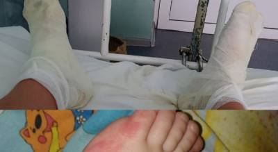 "Выносил детей на руках, шлепая по кипятку": в Рыбинске обварилась семья - progorod76.ru - Рыбинск