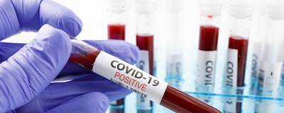 Более ста новых случаев COVID-19 выявлено за сутки в Ивановской области - runews24.ru - Ивановская обл.