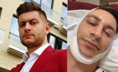 Давид Манукян - Еле разговаривает: Давид Манукян снял видео после операции - bloknot.ru
