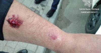 Во Львове пьяный водитель покусал полицейского: суд освободил мужчину от наказания - 24tv.ua - Львов