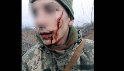 Боевик ДНР пробрался на позиции ВСУ – солдат Герман Г. обезвредил его и будет награжден – фото - ТЕЛЕГРАФ - telegraf.com.ua - ДНР - Донбасс