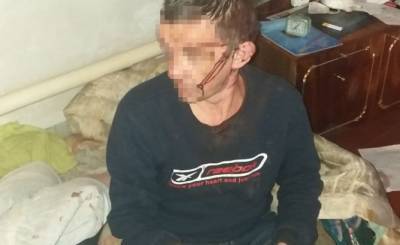 В своем доме уже не спокойно: в Лисичанске совершен разбой (фото) - vchaspik.ua - Лисичанск