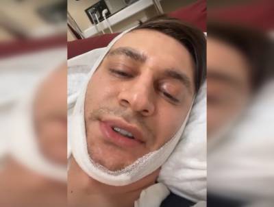 Давид Манукян - Щеки все равно висят: Даве сделали неудачную пластическую операцию - inforeactor.ru