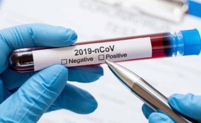 Жан Кастекс - Во Франции увеличивается количество больных COVID-19 - unn.com.ua - Киев - Франция