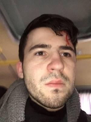 В Москве задержанный и избитый фотограф несколько часов ждал очереди на арест в приемнике - znak.com - Москва - Екатеринбург