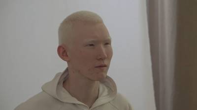 Фотограф из Казахстана прославил парня-альбиноса. - riafan.ru - Атырау