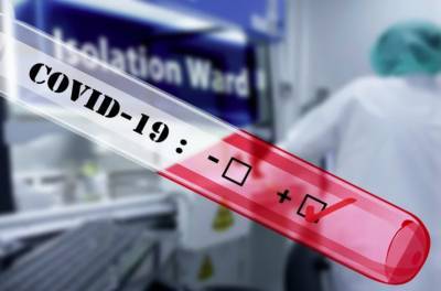 Израильский препарат от COVID 96% эффективности проходит стадию испытаний на людях - isroe.co.il - Тель-Авив