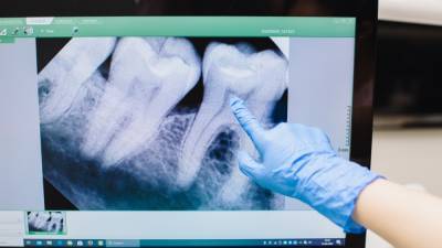 Объяснено влияние заболеваний ЖКТ на зубы человека - polit.info