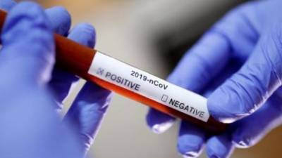 В Украине зафиксировано 2656 новых случаев COVID-19, умерло 127 человек - ru.espreso.tv - Киев - Крым - Луганская обл. - Севастополь - Донецкая обл.