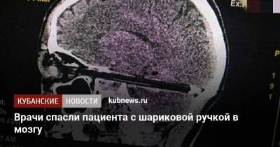 Врачи спасли пациента с шариковой ручкой в мозгу - kubnews.ru - Ростов-На-Дону - Ростов