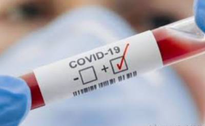 Джонс Хопкинс - Число заражений COVID-19 в мире превысило 106 млн - take-profit.org - США - Бразилия