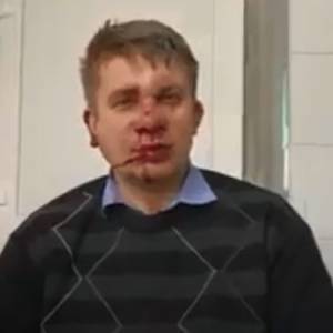 Запорожский депутат рассказал, как произошло нападение. Видео - reporter-ua.com - Запорожье - Нападение