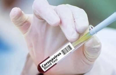 На Киевщине в два раза выросла заболеваемость коронавирусом - lenta.ua - Киевская обл.