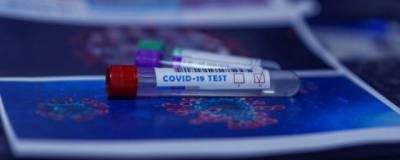 В Удмуртии за сутки выявлено 75 случаев COVID-19 - runews24.ru - респ. Удмуртия