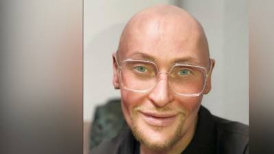 Александр Медведев - Певец Шура напугал фанатов болезненной худобой - inforeactor.ru