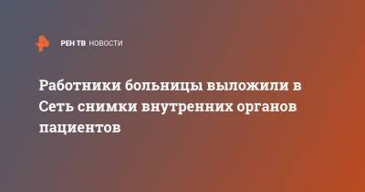 Работники больницы выложили в Сеть снимки внутренних органов пациентов - ren.tv - США - USA - шт. Мичиган