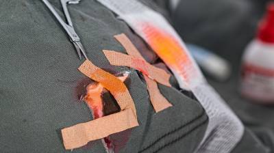 В Воронежской области женщина пырнула мужа ножом и заклеила рану пластырем - vestivrn.ru - Воронежская обл.