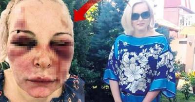 Отрежу тебе лицо: любовник два дня истязал россиянку в отеле в Турции - ren.tv - Турция - Стамбул