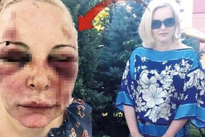 Россиянка приехала к мужчине в Турцию и сбежала через два дня избиений - lenta.ru - Турция - Стамбул