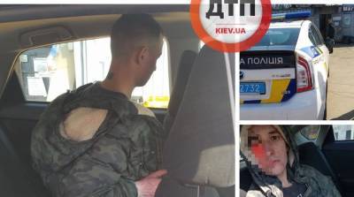 В Киеве живодер покалечил кошку: его поймали и после "воспитательной работы" передали полиции - 24tv.ua - Киев - Одесса - Новости