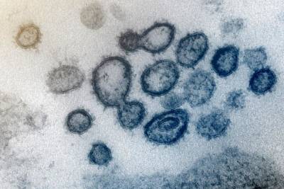 Во Франции - Во Франции новый штамм коронавируса: его нельзя обнаружить по мазкам из носа - 24tv.ua - Финляндия