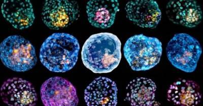 Жизнь из пробирки. В лаборатории созданы первые полные модели эмбриона человека - focus.ua