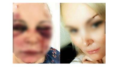 Уфимку двое суток избивал поклонник из Стамбула - bash.news - Турция - Уфа - Стамбул