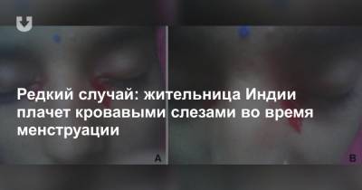 Редкий случай: жительница Индии плачет кровавыми слезами во время менструации - news.tut.by