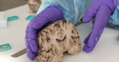 Ученые обнаружили "зомби гены", увеличивающие активность в мозге после смерти - focus.ua