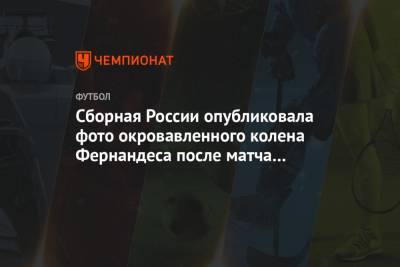 Марио Фернандес - Сборная России опубликовала фото окровавленного колена Фернандеса после матча с Мальтой - championat.com - Мальта - Хорватия - Словения - Кипр - Словакия
