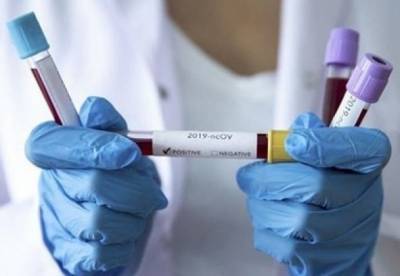Максим Степанов - Антирекорд с начала года: в Украине обнаружили 16 669 новых COVID-заражений - facenews.ua - Киев - Одесская обл. - Житомирская обл.
