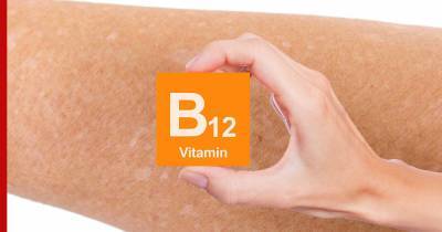 Пятна на теле связали с дефицитом витамина B12 - profile.ru