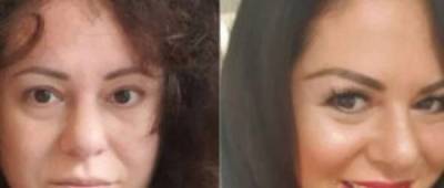 Британка несколько лет не мыла голову и показала, что из этого получилось - w-n.com.ua
