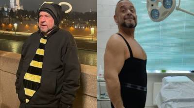 Александр Морозов - Звезда "Кривого зеркала" показал фото после удаления обвисшей кожи - nation-news.ru
