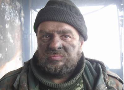 Юрий Бутусов - "Потерял более 50 кг, но боролся до конца": оборвалась жизнь украинского киборга, болезнь оказалась сильней - politeka.net - Киев