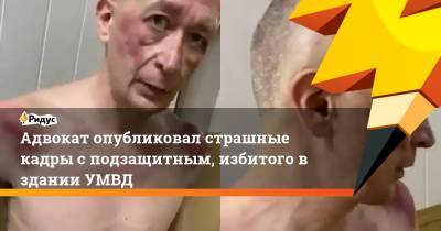 Адвокат опубликовал страшные кадры сподзащитным, избитого вздании УМВД - ridus.ru - Пензенская обл. - Пенза