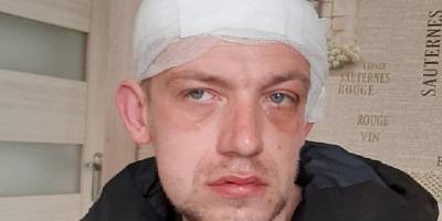 В Береговом группа цыган напала на ветерана АТО, избив до полусмерти - ТЕЛЕГРАФ - telegraf.com.ua - Киев