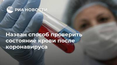 Андрей Звонков - Назван способ проверить состояние крови после коронавируса - ria.ru - Москва