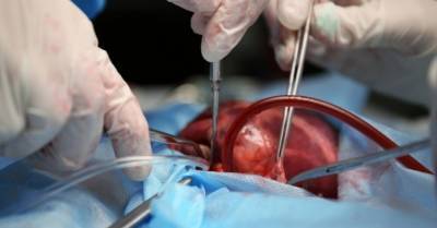Органы одного человека спасли жизнь двум людям из Латвии и двум из Литвы - rus.delfi.lv - Литва - Вильнюс - Рига - Латвия