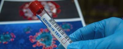 В Орловской области выполнено 488 тысяч исследований на COVID-19 - runews24.ru - Орловская обл.