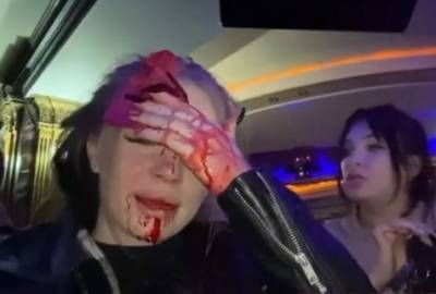 В ГУ МЧС по Приморью началась проверка по факту нападения на блогера Олесю Рожкову - znak.com - Приморье край