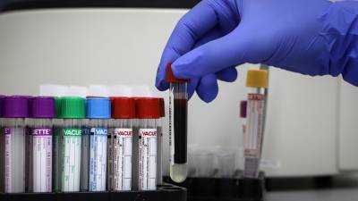 Анастасия Ракова - Более 113,5 млн лабораторных исследований: в России выявлено 10 253 новых случая COVID-19 - russian.rt.com - Москва