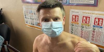 Алексей Гончаренко - Депутат Верховной Рады Алексей Гончаренко сделал укол вакцины от COVID-19, фото - ТЕЛЕГРАФ - telegraf.com.ua - Одесса