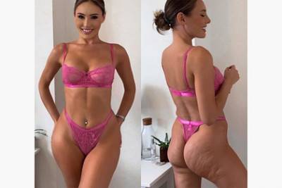 Модель показала целлюлит на фото и призвала отказаться от сокрытия недостатков - lenta.ru