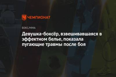 Девушка-боксёр, взвешивавшаяся в эффектном белье, показала пугающие травмы после боя - championat.com - Лондон