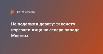 Не поделили дорогу: таксисту изрезали лицо на северо-западе Москвы - ren.tv - Москва