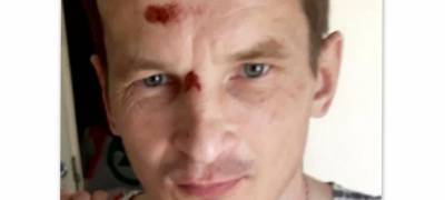 Объявлен в розыск мужчина, который ушел из инфекционной больницы в Петрозаводске и пропал - stolicaonego.ru - Петрозаводск