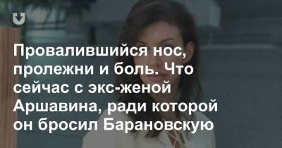 Провалившийся нос, пролежни и боль. Что сейчас с экс-женой Аршавина, ради которой он бросил Барановскую - news.tut.by