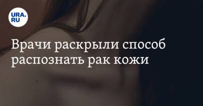 Врачи раскрыли способ распознать рак кожи - ura.news - Царьград
