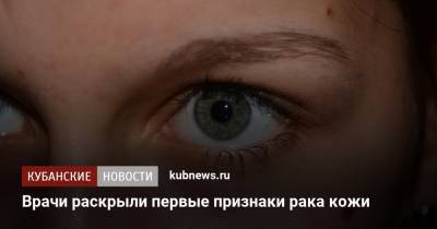 Врачи раскрыли первые признаки рака кожи - kubnews.ru